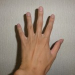 【指ポキ】指をポキポキ鳴らすやり方！そして10年続けた私の手の変化